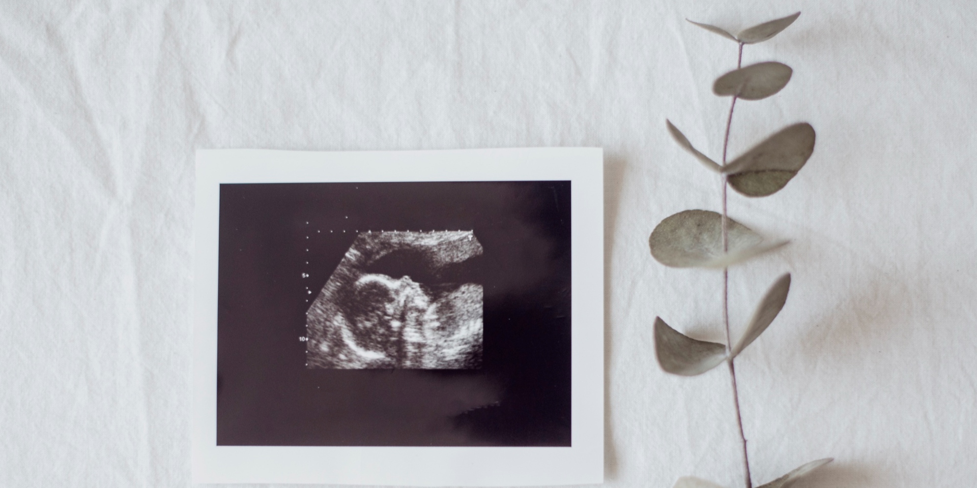 Charlas Baby News: Ecografía 4d con ECOX
